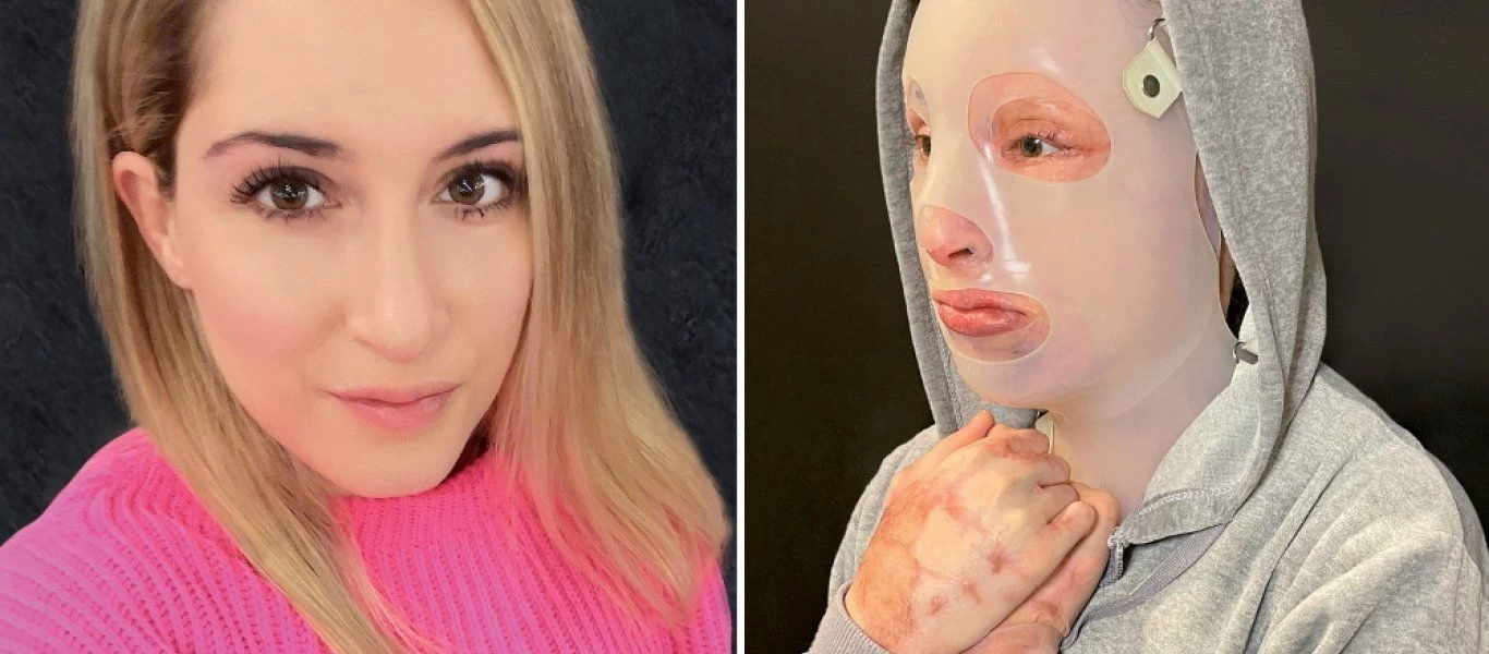 Υπόθεση Ι.Παλιοσπύρου: Η 36χρονη τηλεφώνησε σε τρία πρόσωπα μετά την επίθεση με το βιτριόλι